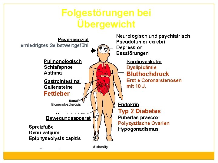 Folgestörungen bei Übergewicht Psychosozial erniedrigtes Selbstwertgefühl Neurologisch und psychiatrisch Pseudotumor cerebri Depression Essstörungen Pulmonologisch
