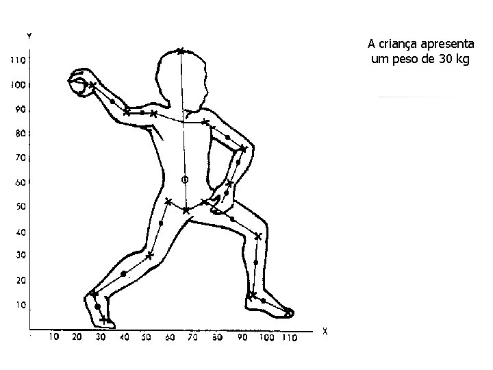 A criança apresenta um peso de 30 kg 