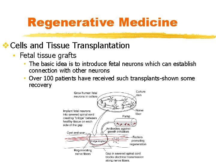 Regenerative Medicine v Cells and Tissue Transplantation • Fetal tissue grafts • The basic