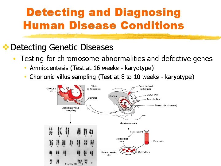 Detecting and Diagnosing Human Disease Conditions v Detecting Genetic Diseases • Testing for chromosome
