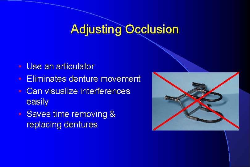 Adjusting Occlusion • Use an articulator • Eliminates denture movement • Can visualize interferences