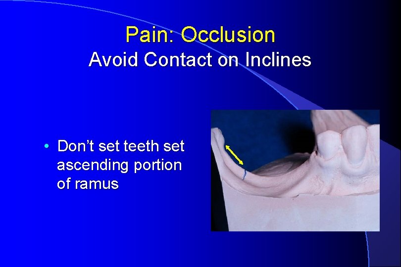 Pain: Occlusion Avoid Contact on Inclines • Don’t set teeth set ascending portion of