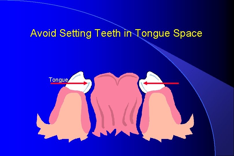 Avoid Setting Teeth in Tongue Space Tongue 