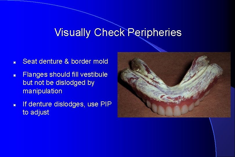 Visually Check Peripheries Seat denture & border mold Flanges should fill vestibule but not