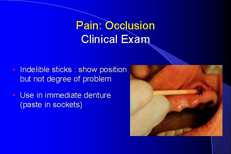 Pain: Occlusion Clinical Exam • Indelible sticks : show position but not degree of