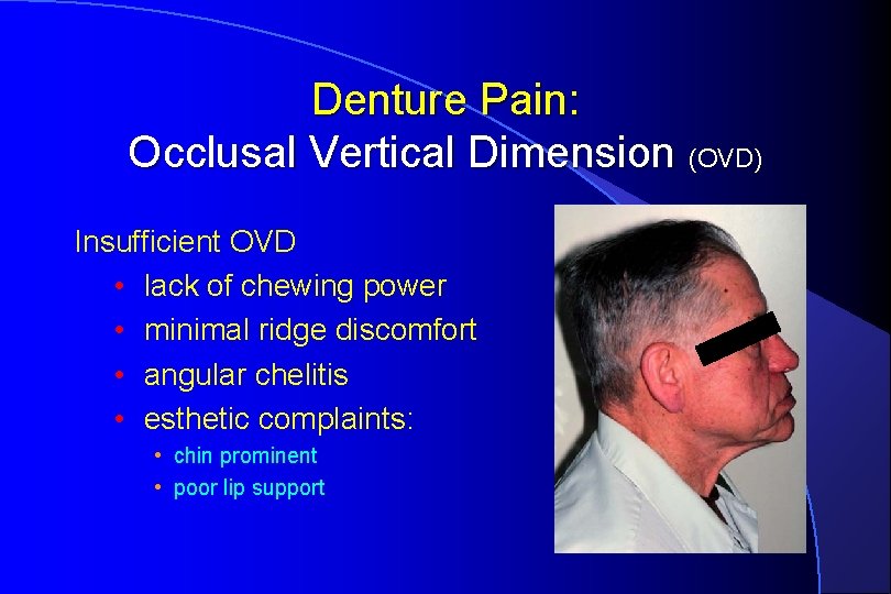 Denture Pain: Occlusal Vertical Dimension (OVD) Insufficient OVD • lack of chewing power •