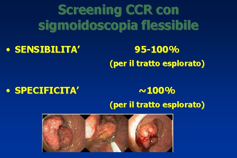 Screening CCR con sigmoidoscopia flessibile • SENSIBILITA’ 95 -100% (per il tratto esplorato) •