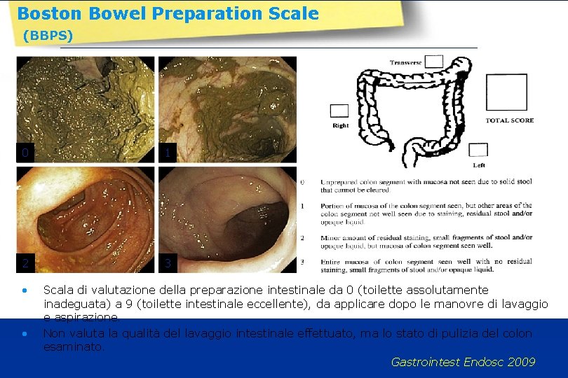 Boston Bowel Preparation Scale (BBPS) 0 1 2 3 • • Scala di valutazione