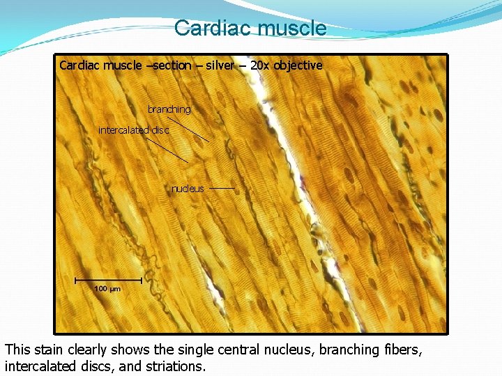 Cardiac muscle –section – silver – 20 x objective branching intercalated disc nucleus This