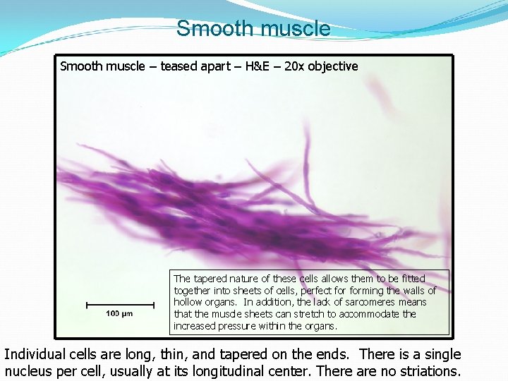 Smooth muscle – teased apart – H&E – 20 x objective The tapered nature