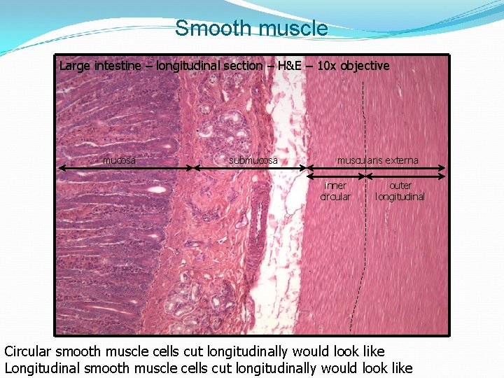 Smooth muscle Large intestine – longitudinal section – H&E – 10 x objective mucosa