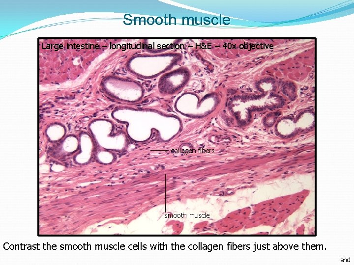 Smooth muscle Large intestine – longitudinal section – H&E – 40 x objective collagen