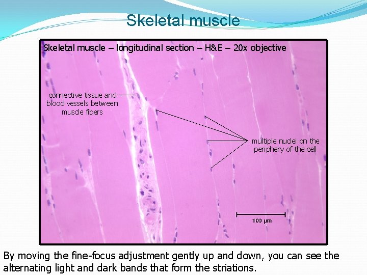 Skeletal muscle – longitudinal section – H&E – 20 x objective connective tissue and