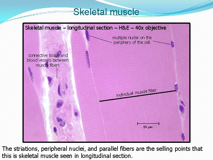 Skeletal muscle – longitudinal section – H&E – 40 x objective multiple nuclei on