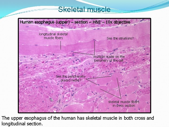 Skeletal muscle Human esophagus (upper) – section – H&E – 10 x objective longitudinal