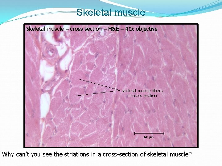 Skeletal muscle – cross section – H&E – 40 x objective skeletal muscle fibers