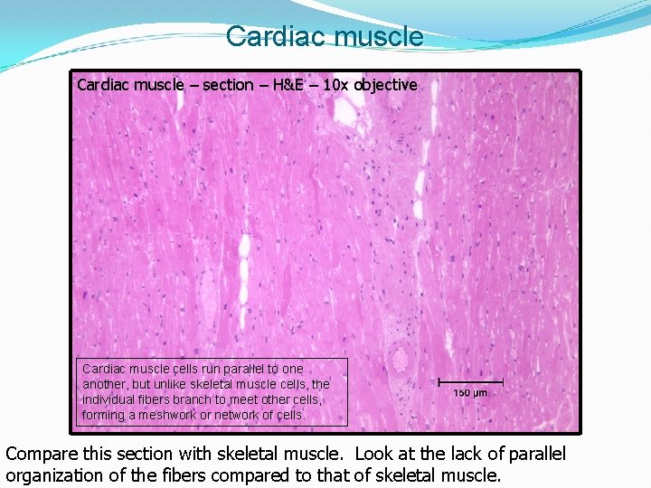 Cardiac muscle – section – H&E – 10 x objective Cardiac muscle cells run