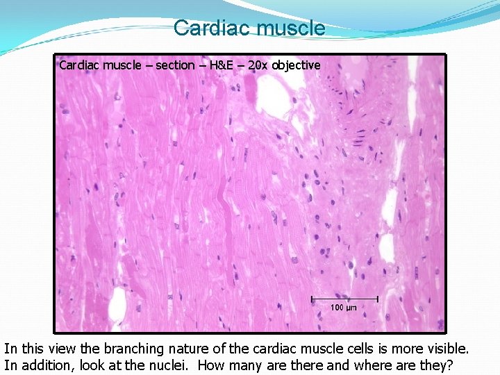 Cardiac muscle – section – H&E – 20 x objective In this view the