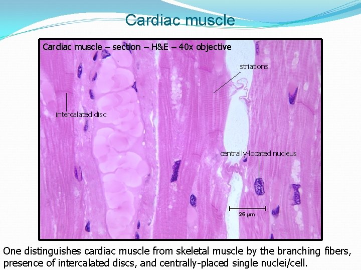 Cardiac muscle – section – H&E – 40 x objective striations intercalated disc centrally-located