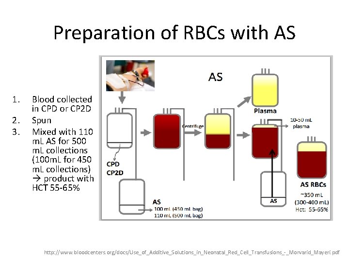 Preparation of RBCs with AS 1. 2. 3. Blood collected in CPD or CP