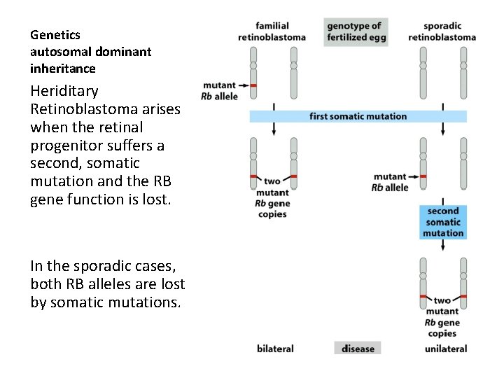 Genetics autosomal dominant inheritance Heriditary Retinoblastoma arises when the retinal progenitor suffers a second,