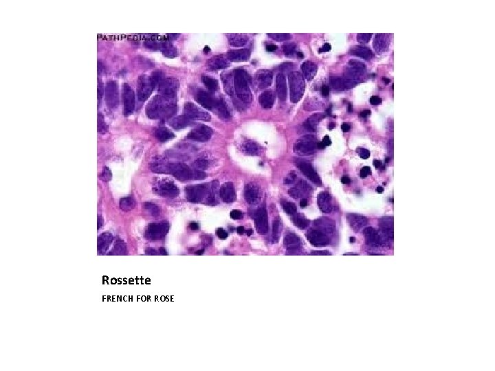 Rossette FRENCH FOR ROSE 