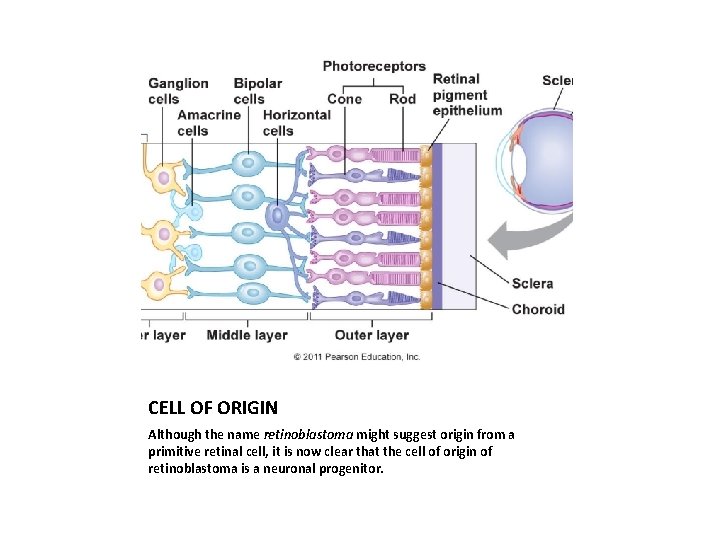 CELL OF ORIGIN Although the name retinoblastoma might suggest origin from a primitive retinal