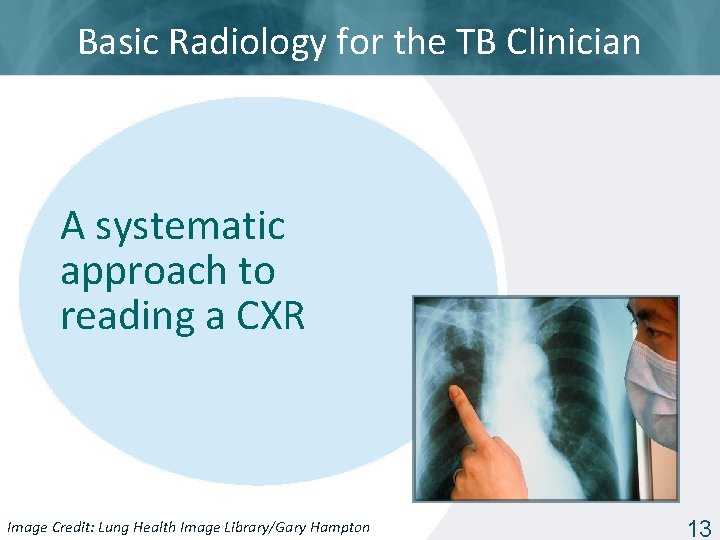 Basic Radiology for the TB Clinician A systematic approach to reading a CXR Image