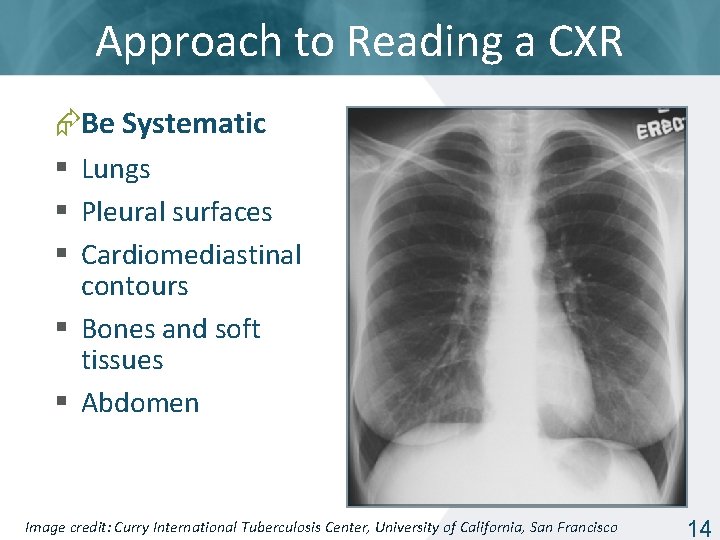 Approach to Reading a CXR Be Systematic § Lungs § Pleural surfaces § Cardiomediastinal