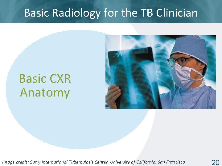Basic Radiology for the TB Clinician Basic CXR Anatomy Image Tuberculosis Center, University of