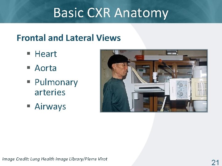 Basic CXR Anatomy Frontal and Lateral Views § Heart § Aorta § Pulmonary arteries