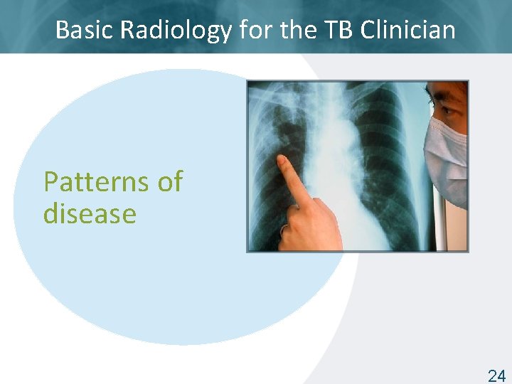 Basic Radiology for the TB Clinician Patterns of disease ISTC TB Training Modules 2009