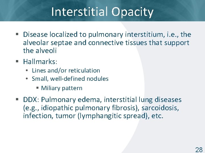 Interstitial Opacity § Disease localized to pulmonary interstitium, i. e. , the alveolar septae