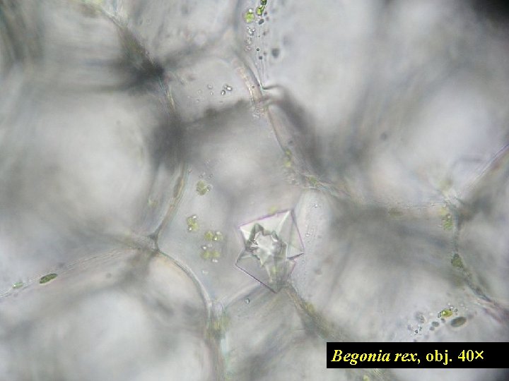 Begonia rex, obj. 40× 