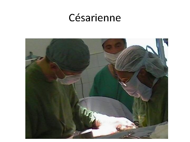 Césarienne 