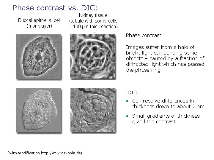 Phase contrast vs. DIC: Buccal epithelial cell (monolayer) Kidney tissue (tubule with some cells