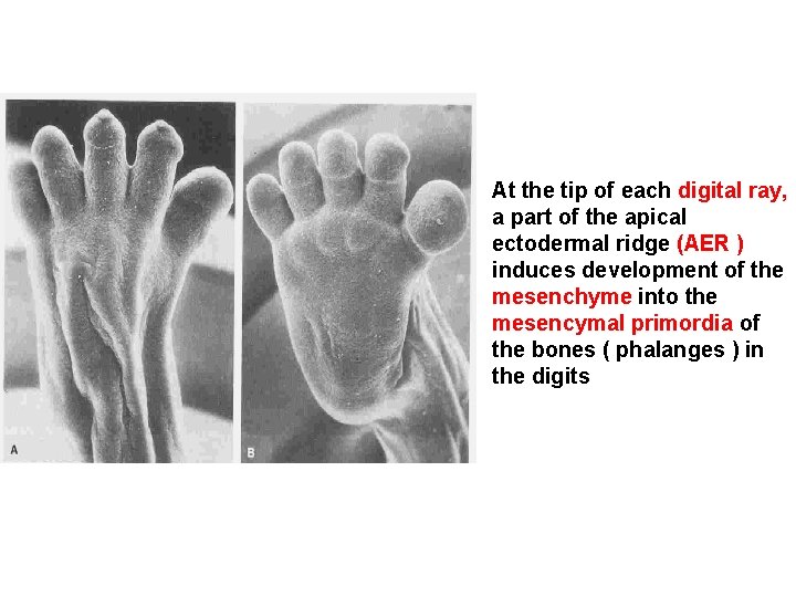 At the tip of each digital ray, a part of the apical ectodermal ridge