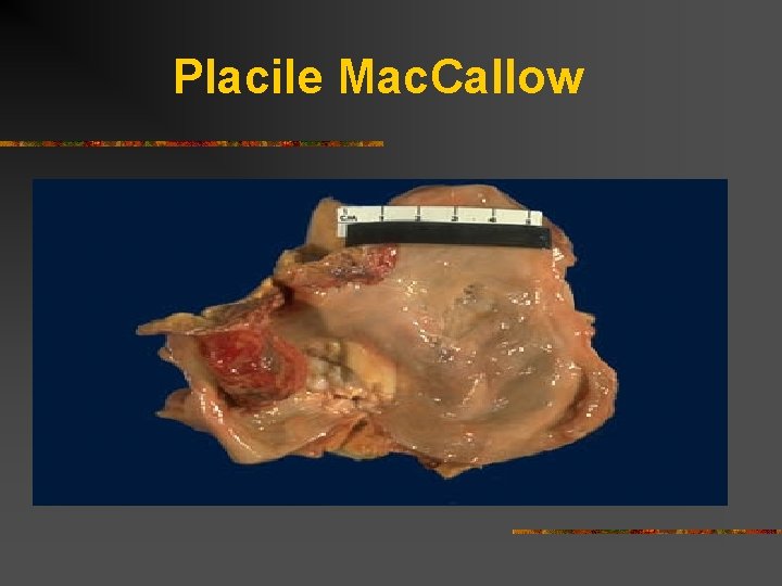Placile Mac. Callow 