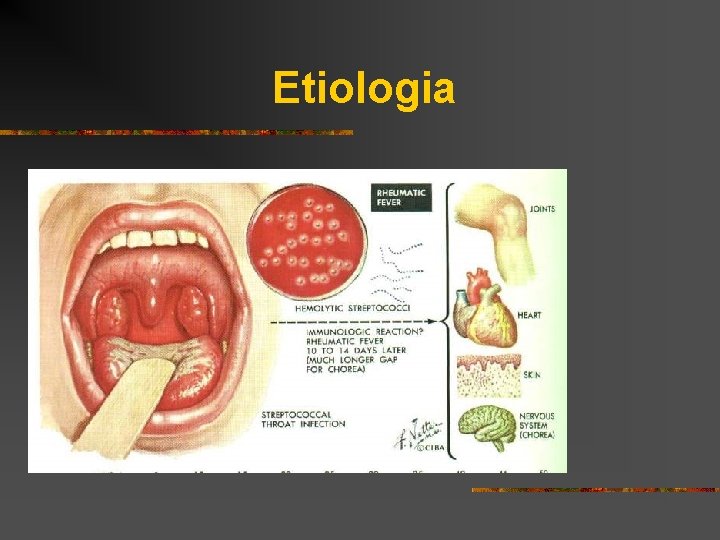 Etiologia 