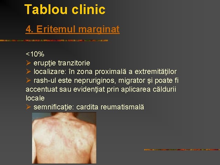 Tablou clinic 4. Eritemul marginat <10% Ø erupţie tranzitorie Ø localizare: în zona proximală