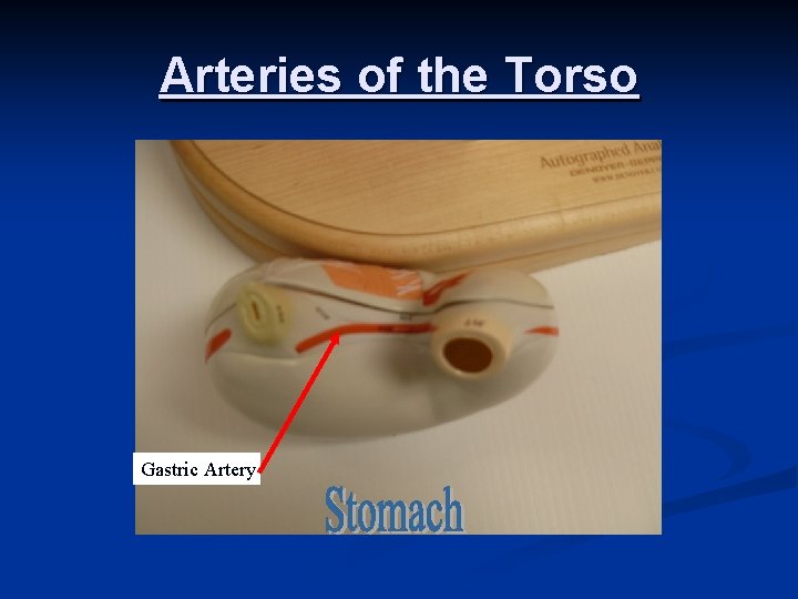 Arteries of the Torso Gastric Artery 