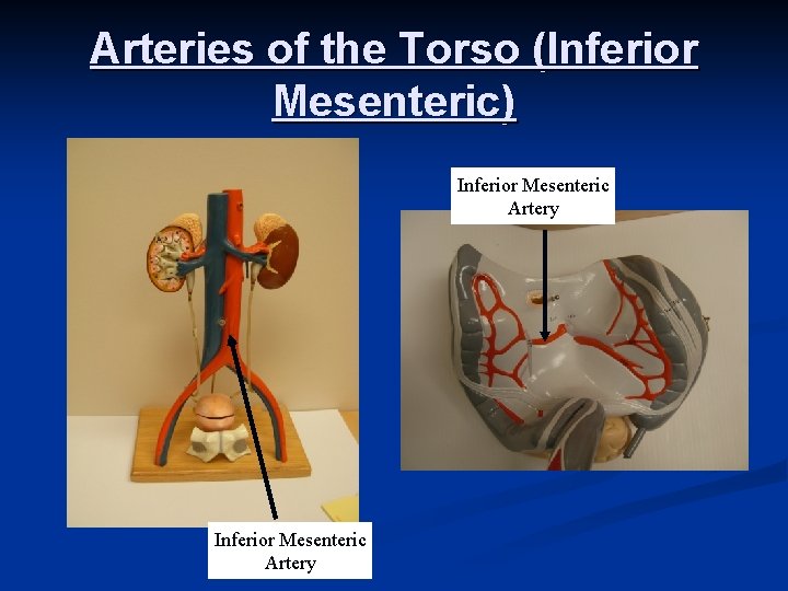 Arteries of the Torso (Inferior Mesenteric) Inferior Mesenteric Artery 