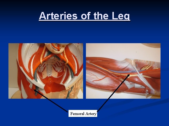 Arteries of the Leg Femoral Artery 