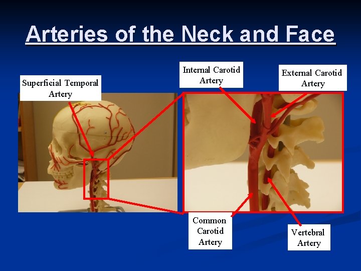 Arteries of the Neck and Face Superficial Temporal Artery Internal Carotid Artery Common Carotid