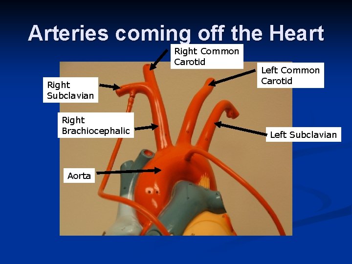 Arteries coming off the Heart Right Common Carotid Right Subclavian Right Brachiocephalic Aorta Left