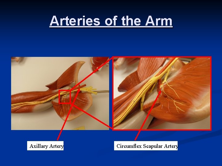 Arteries of the Arm Axillary Artery Circumflex Scapular Artery 