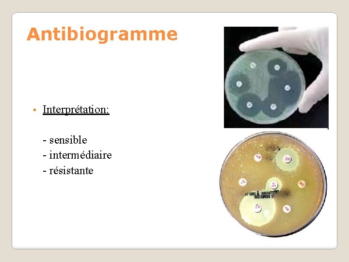 Antibiogramme • Interprétation: - sensible - intermédiaire - résistante 
