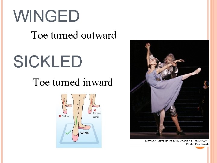 WINGED Toe turned outward SICKLED Toe turned inward 