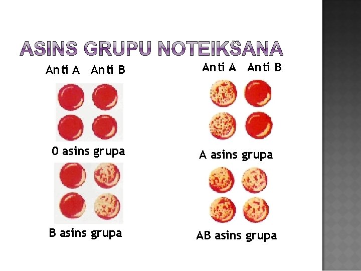 Anti A Anti B 0 asins grupa A asins grupa B asins grupa AB
