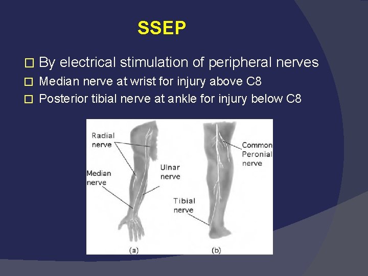 SSEP � By electrical stimulation of peripheral nerves Median nerve at wrist for injury